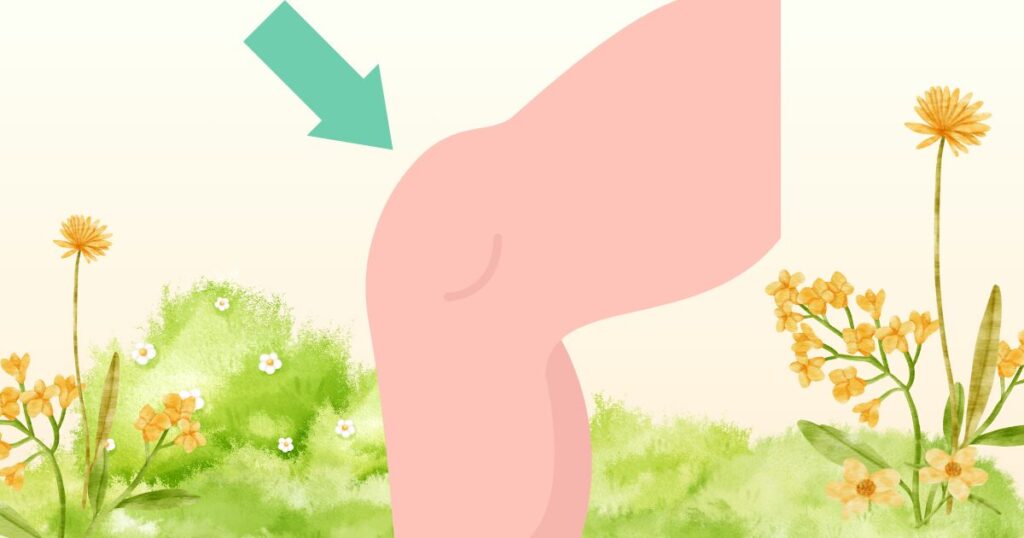 기혈순환장애