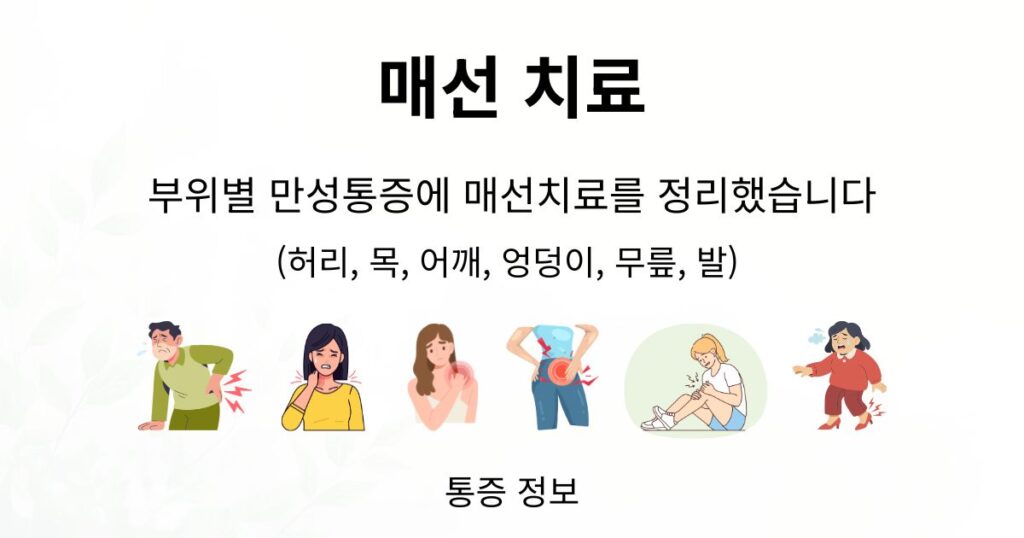 매선치료